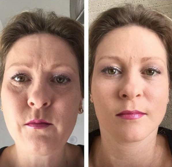 Kāpēc mēdzam aizmirst par gravitāciju?! Sejas āda kļūs ideāla, ja fotoaparātu turēsim vertikāli virs tās (Starp citu, lūk arī āķis, uz kur ķer brīnumkrēmu reklāmās!)